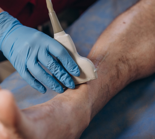Vascular Ultrasound procedure on patient